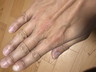 Lshotを手に塗る前画像